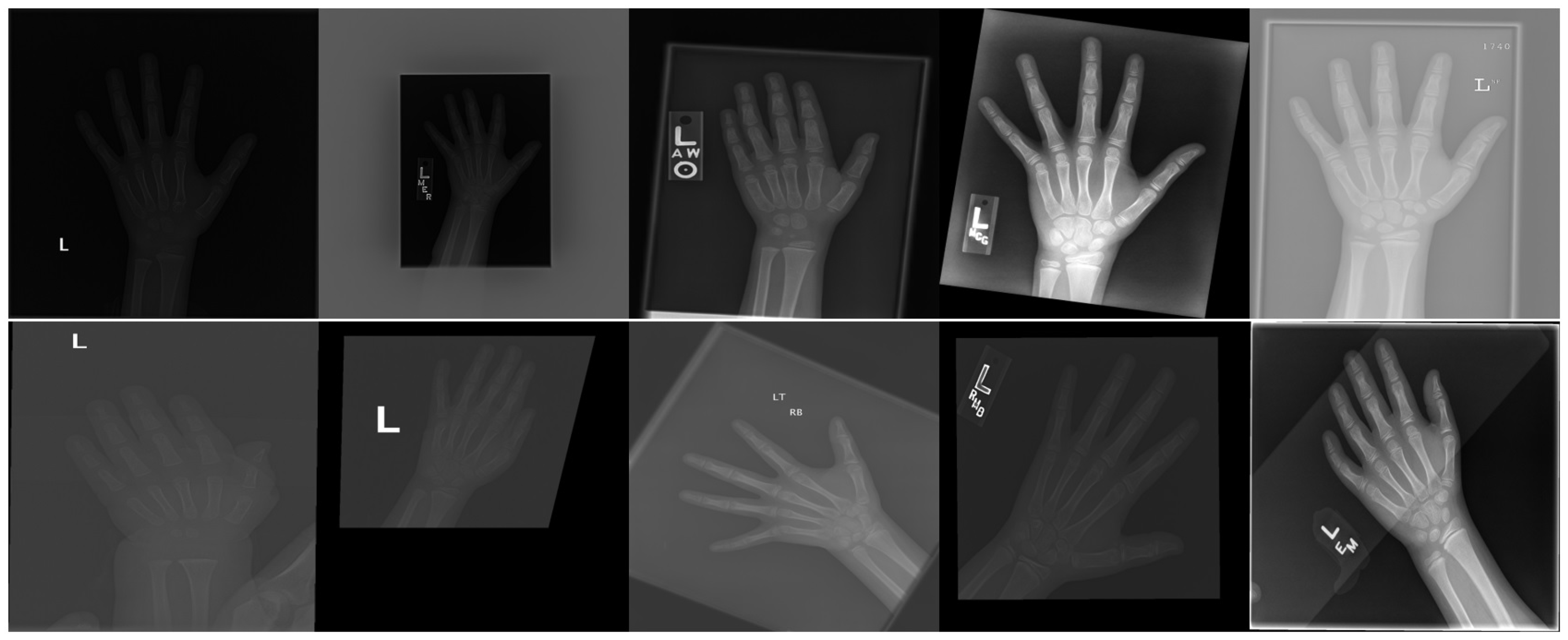 Applied Sciences Free FullText Automated Bone Age Assessment with