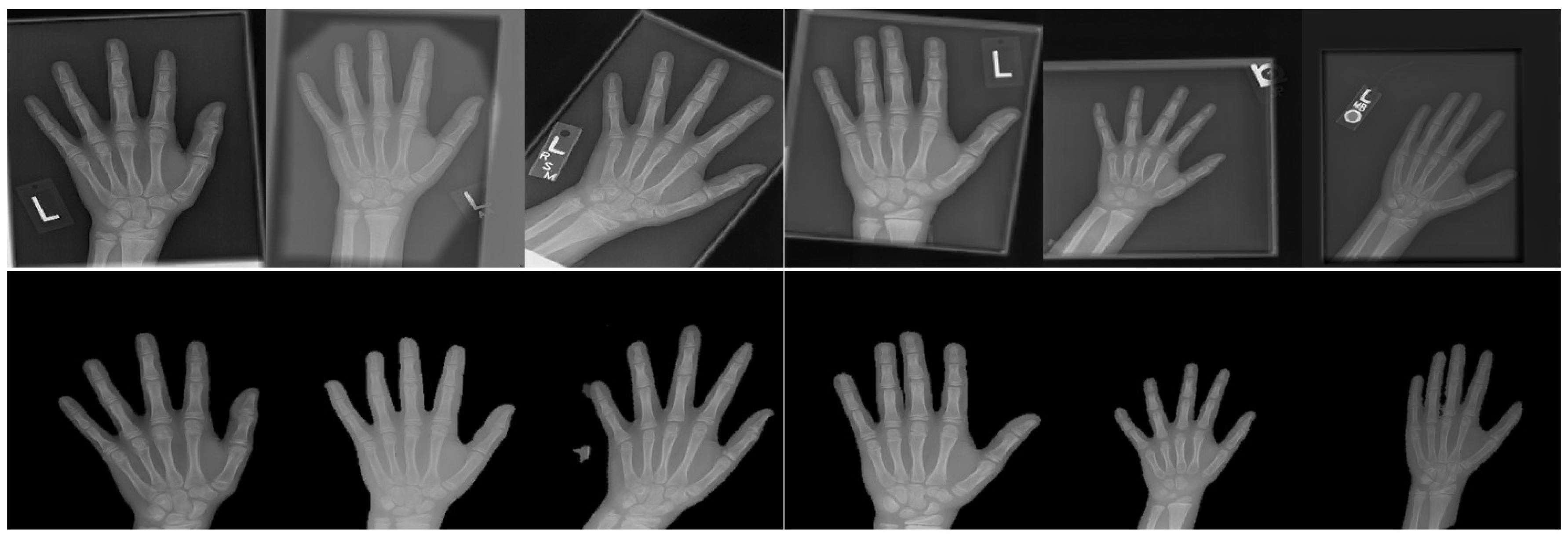 Applied Sciences Free FullText Automated Bone Age Assessment with