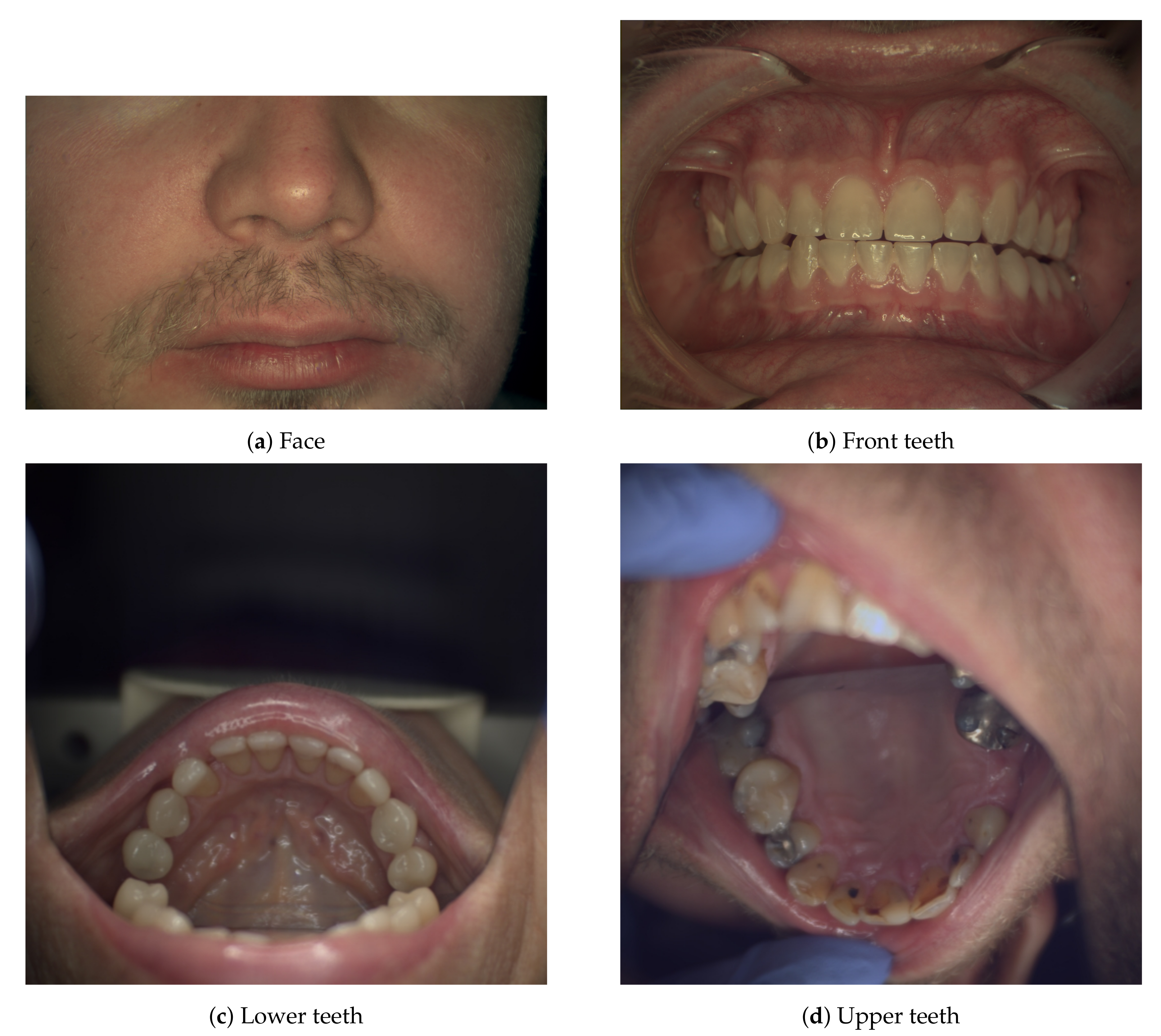 Applsci 10 07246 g003