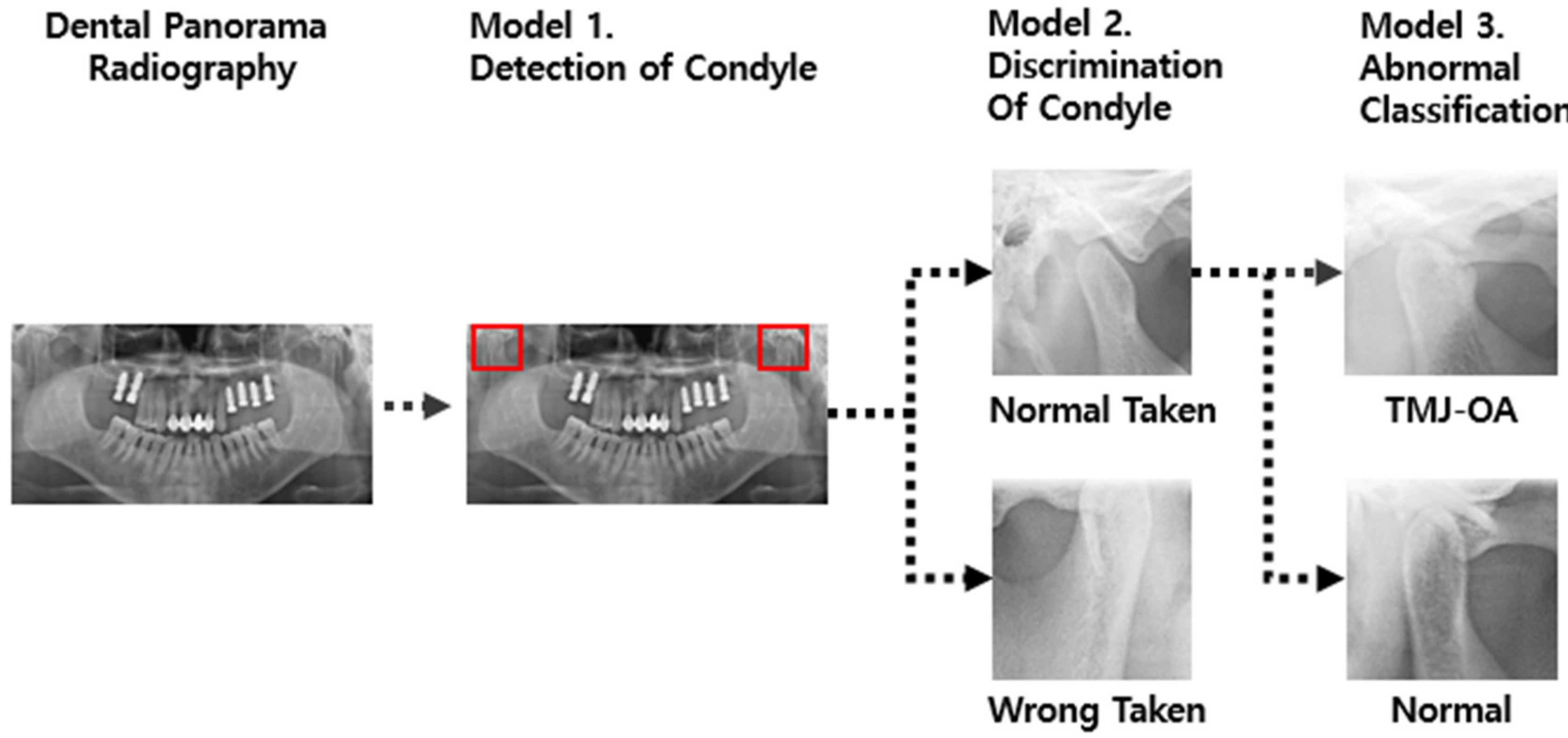 Expert System for Mandibular Condyle Detection and