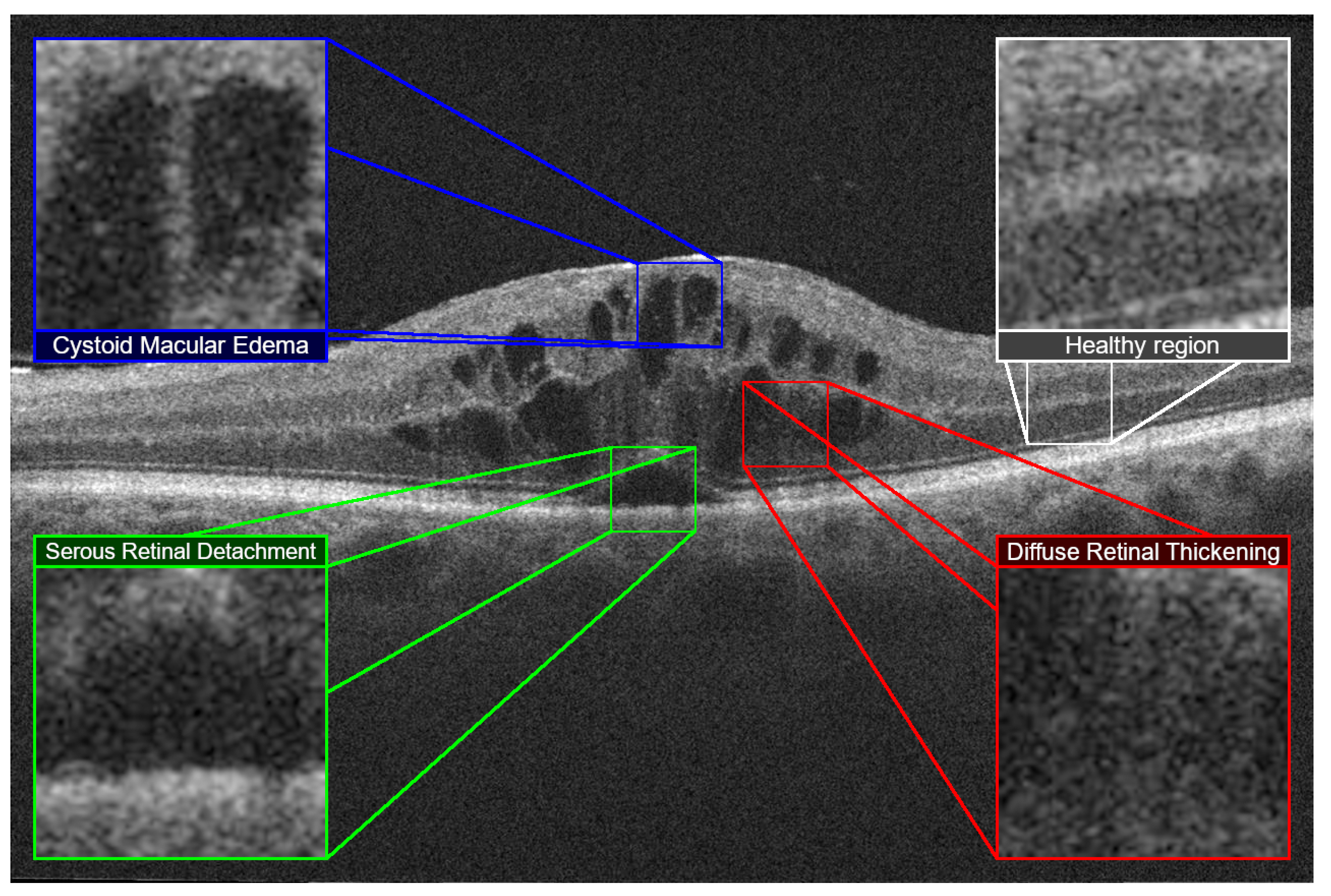 Applsci 10 07718 g001