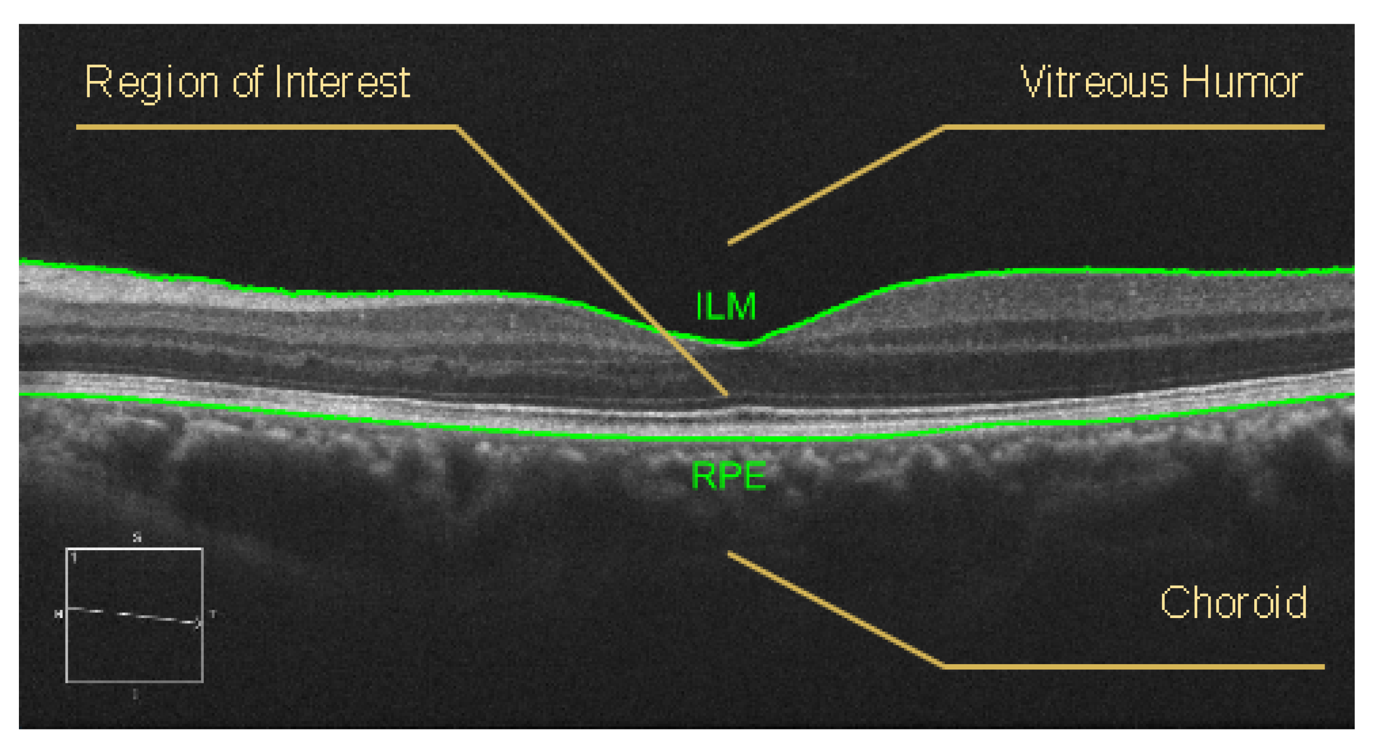 Applsci 10 07718 g004
