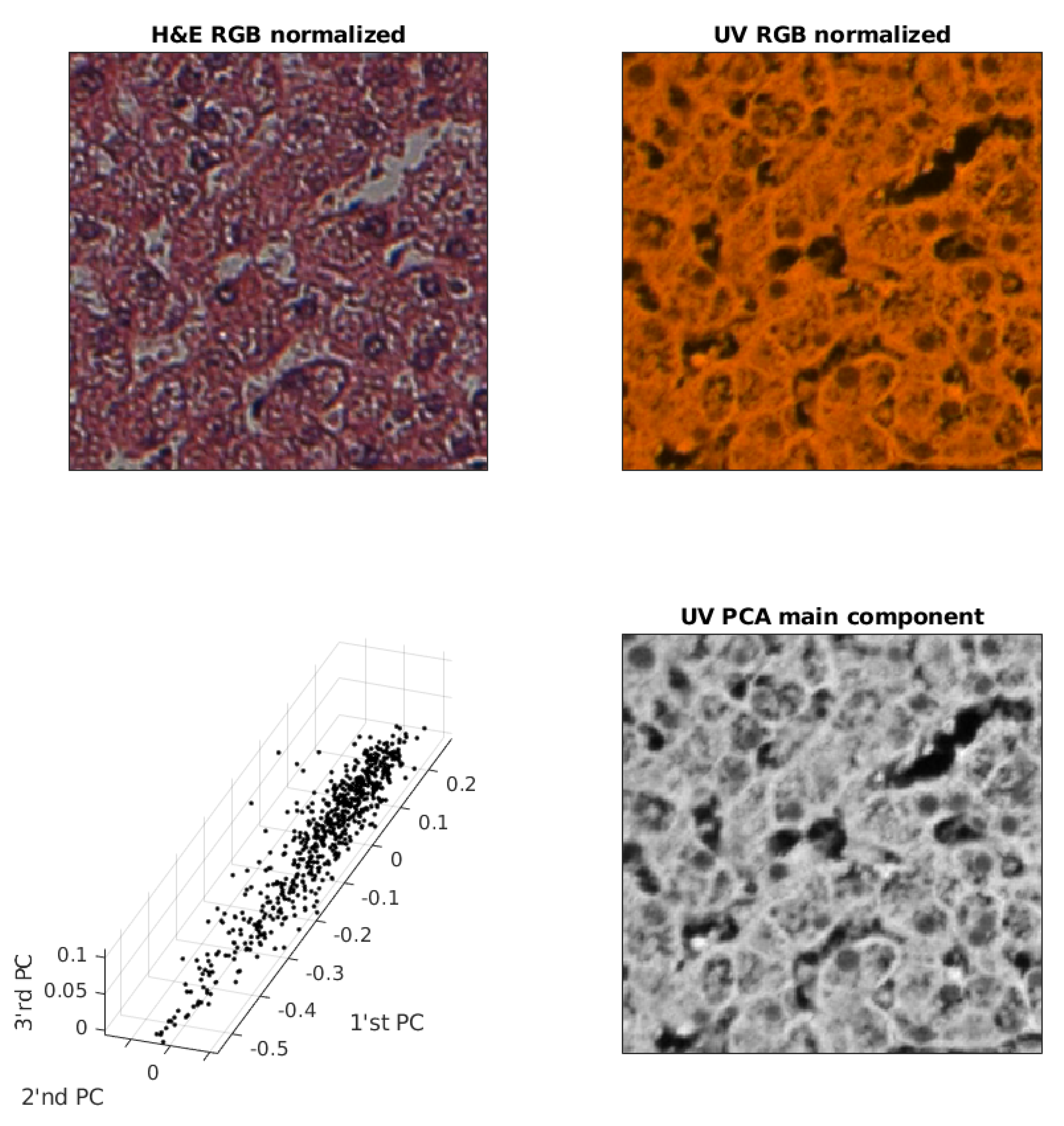 Applied Sciences Free Full Text Virtual Uv Fluorescence Microscopy From Hematoxylin And Eosin Staining Of Liver Images Using Deep Learning Convolutional Neural Network Html