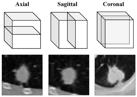 Applied Sciences | Free Full-Text | Pre-Training Autoencoder for Lung ...