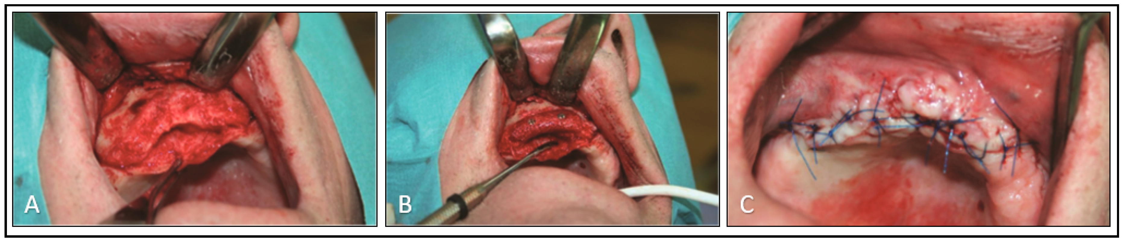 Applsci 10 08039 g004 Applsci 10 08039 g004