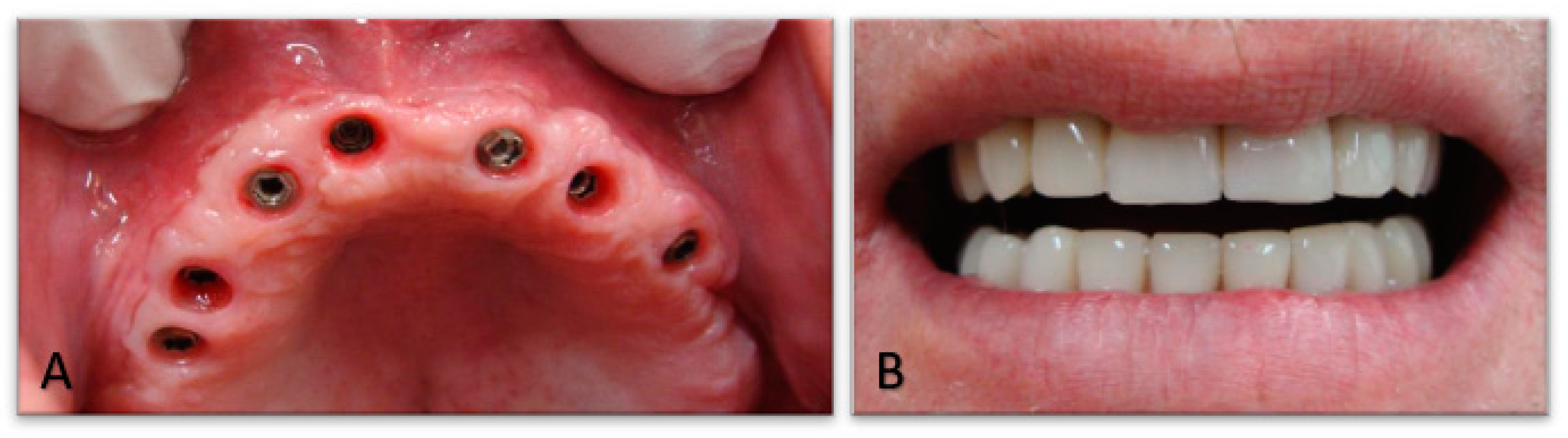 Applsci 10 08039 g010 Applsci 10 08039 g010