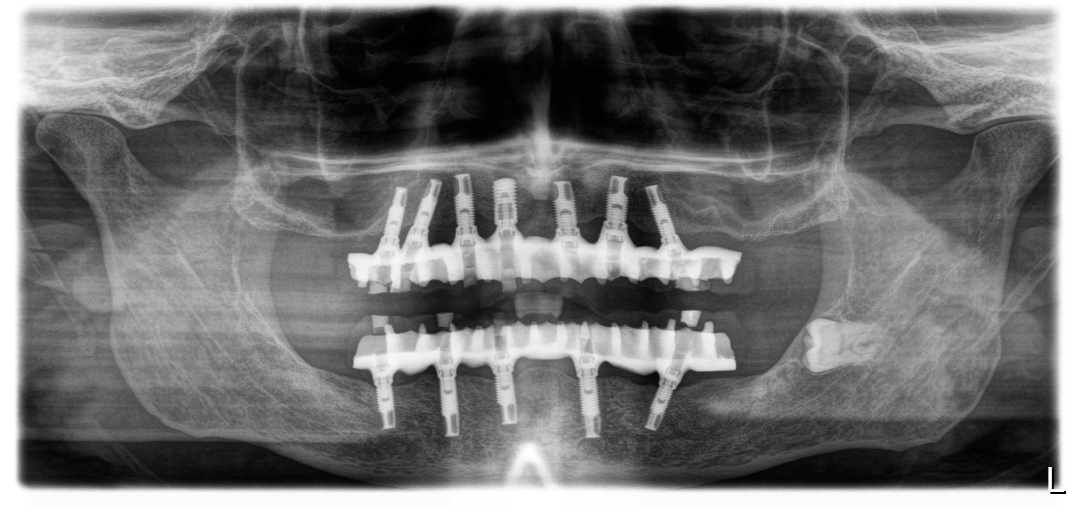 Applsci 10 08039 g012 Applsci 10 08039 g012