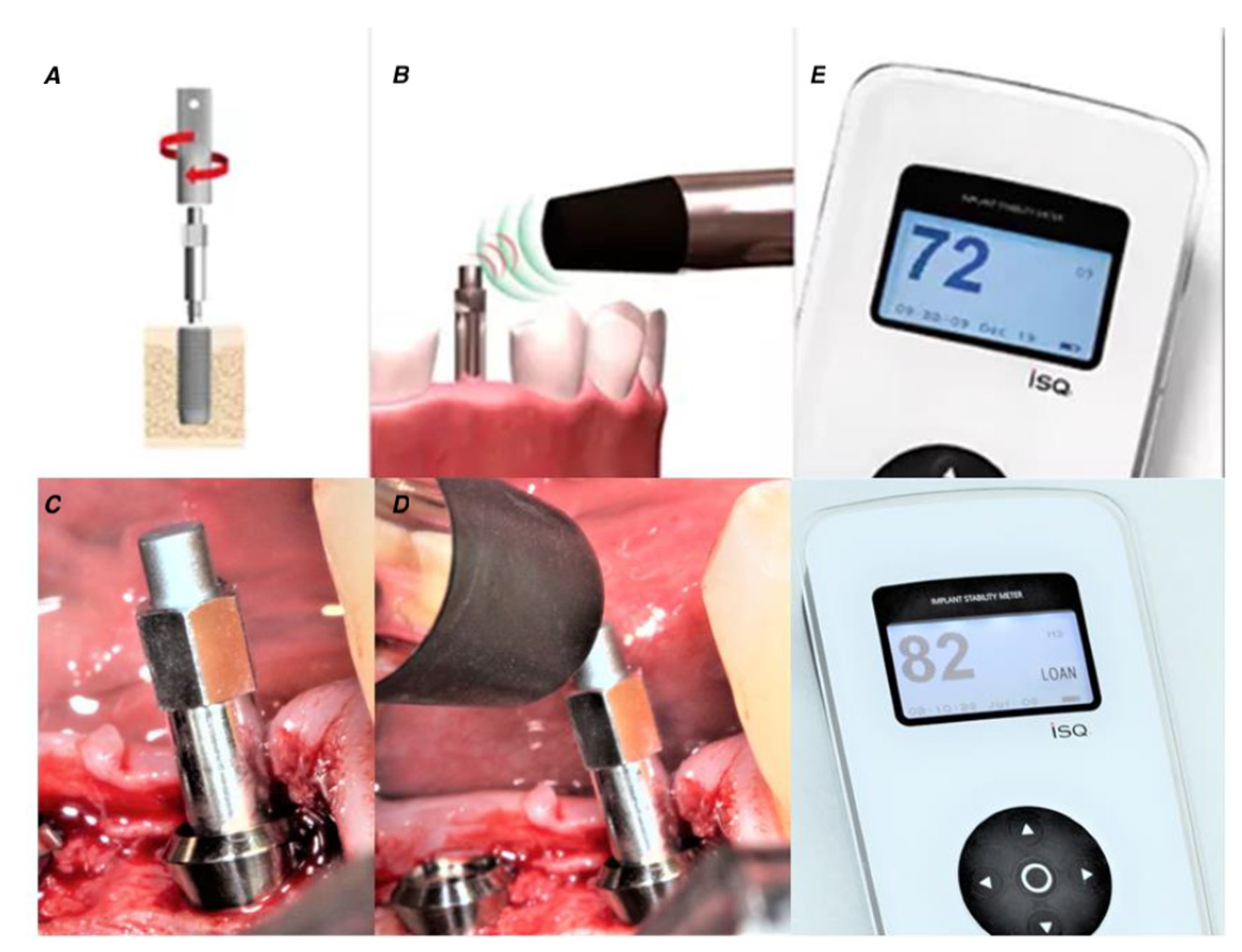 Applied Sciences Free FullText Factors Influencing Primary and