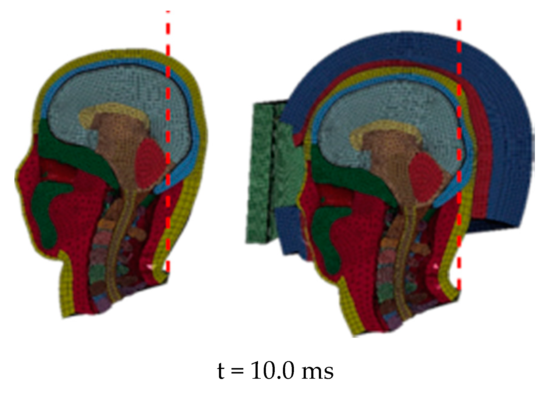 Applsci 10 08227 g007b Applsci 10 08227 g007b