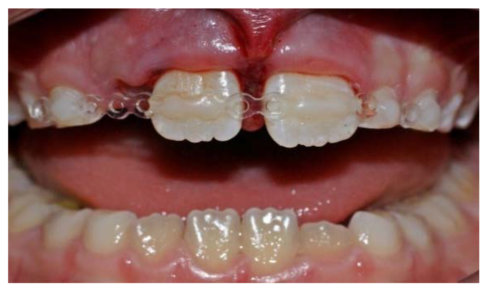 Applied Sciences Free FullText Assessment of a Power Chain as a