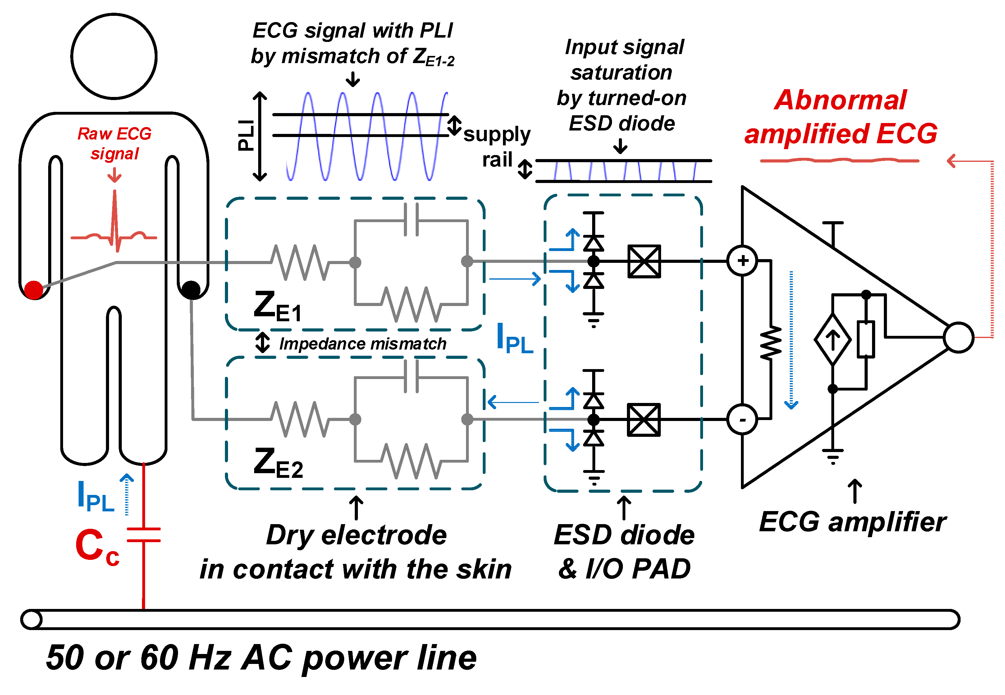Applied Sciences Free FullText Power Line Interference Reduction