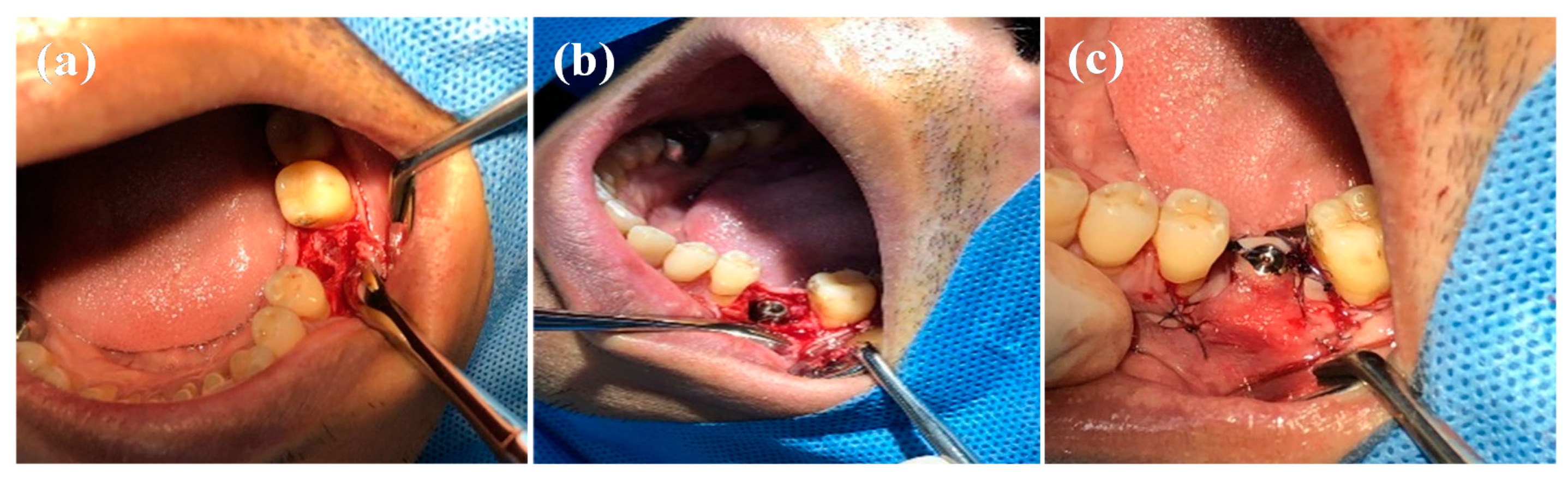 Applsci 10 08582 g002 Applsci 10 08582 g002