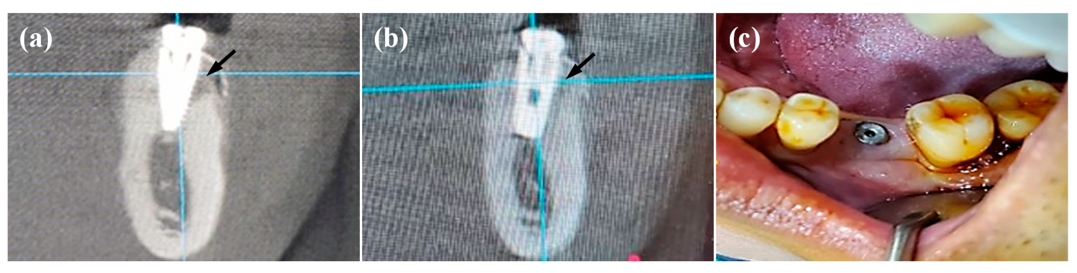 Applsci 10 08582 g006 Applsci 10 08582 g006