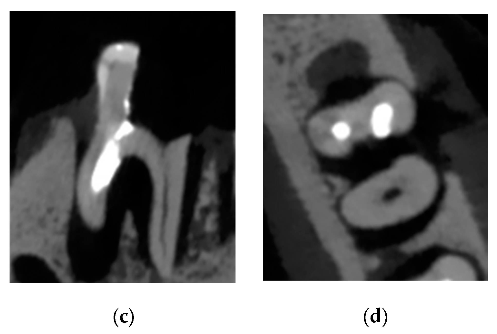 Applsci 10 08726 g002b Applsci 10 08726 g002b