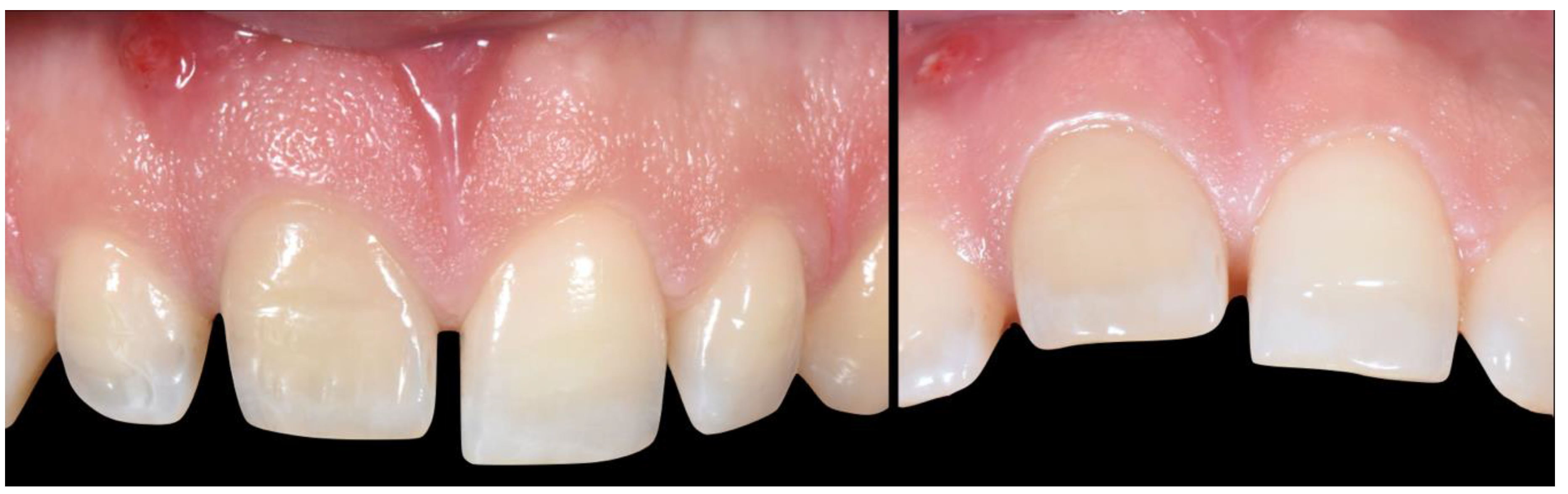 Applsci 10 08944 g003 Applsci 10 08944 g003