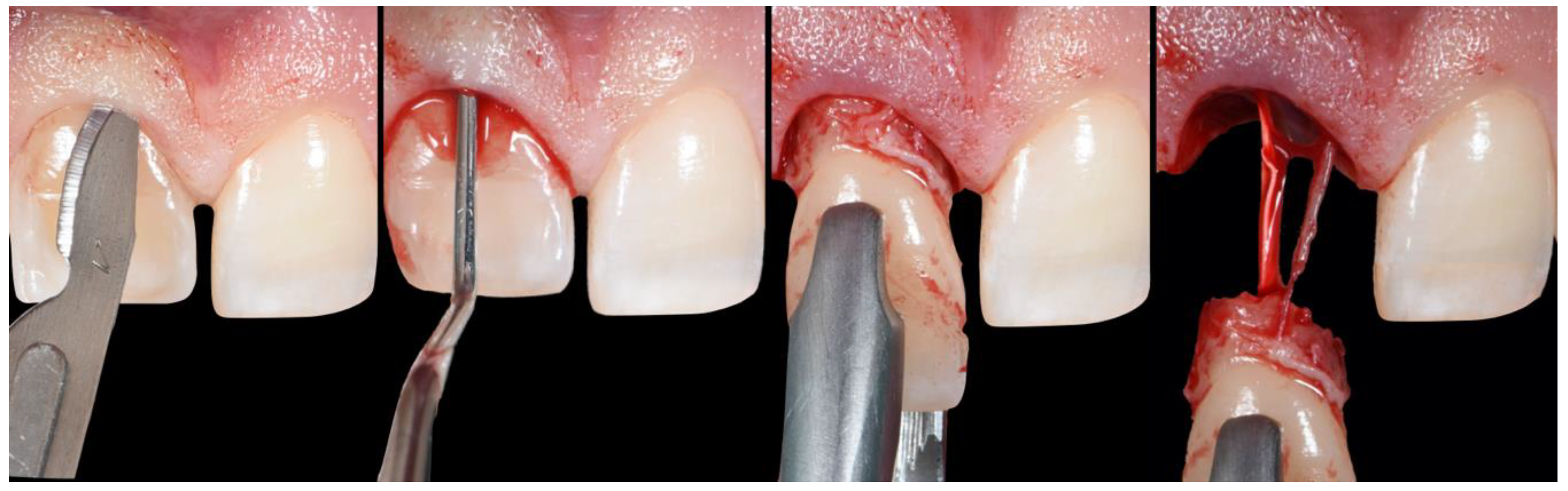 Applsci 10 08944 g004 Applsci 10 08944 g004