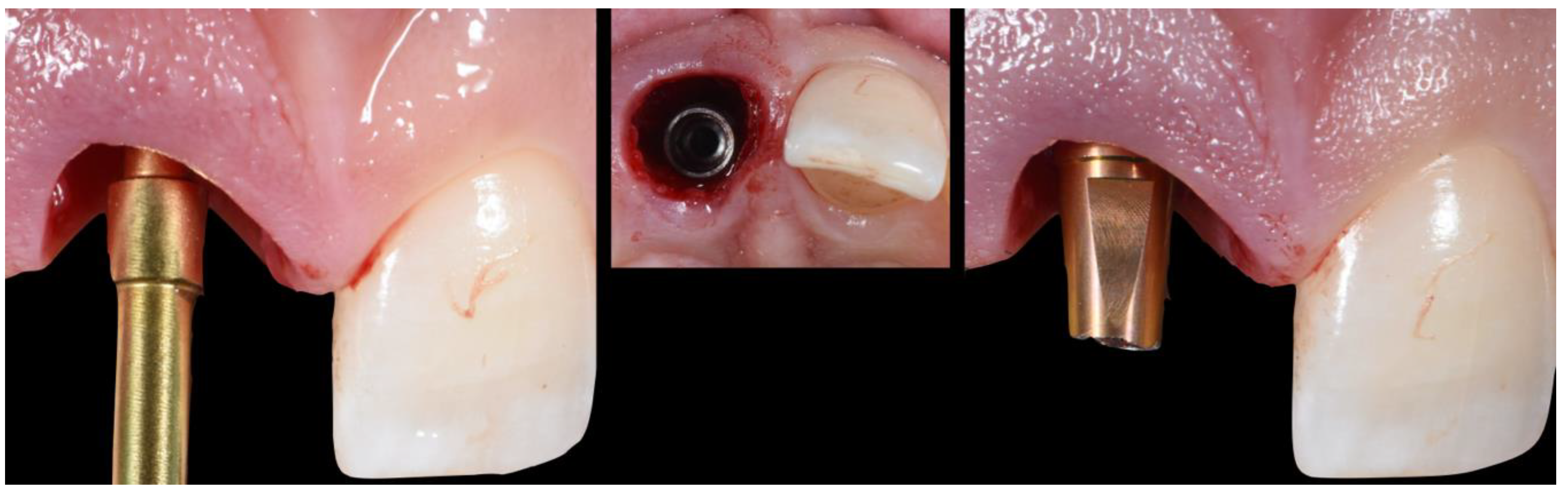 Applsci 10 08944 g005 Applsci 10 08944 g005