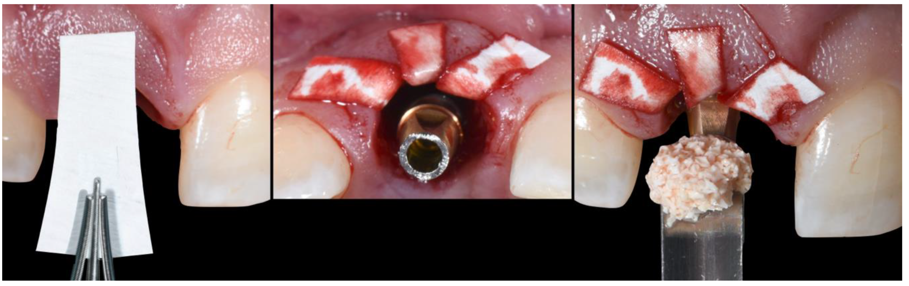 Applsci 10 08944 g006 Applsci 10 08944 g006