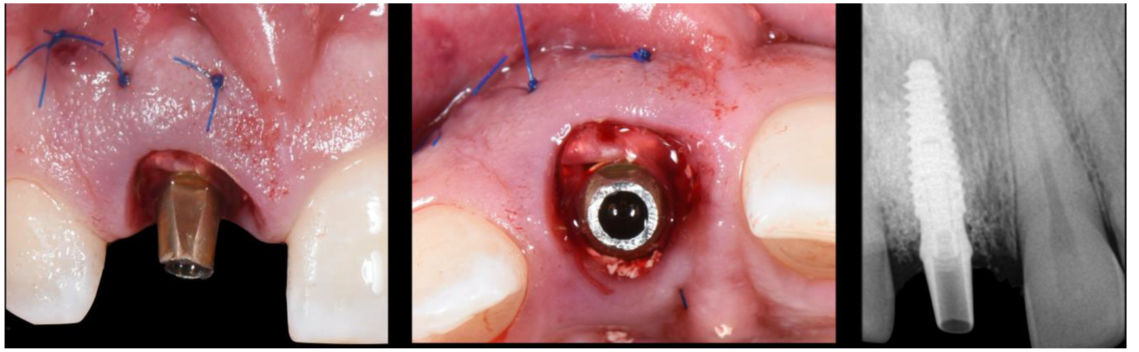 Applsci 10 08944 g008 Applsci 10 08944 g008