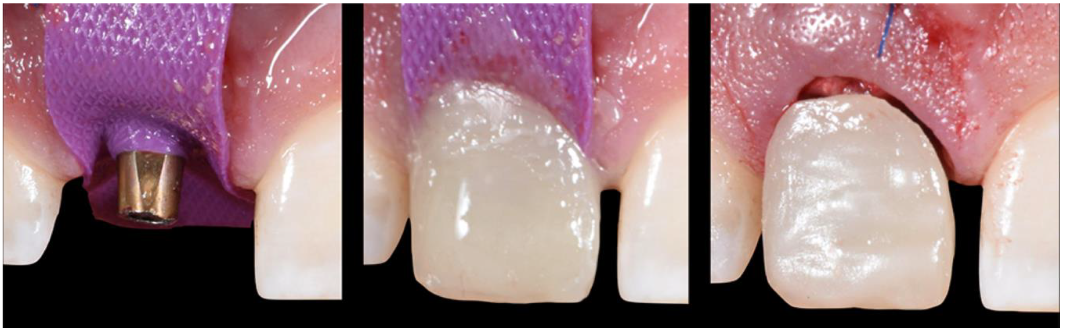 Applsci 10 08944 g009 Applsci 10 08944 g009