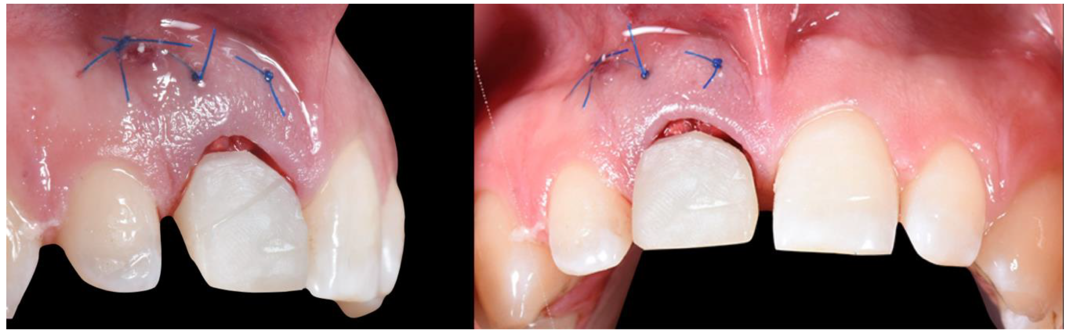 Applsci 10 08944 g010 Applsci 10 08944 g010