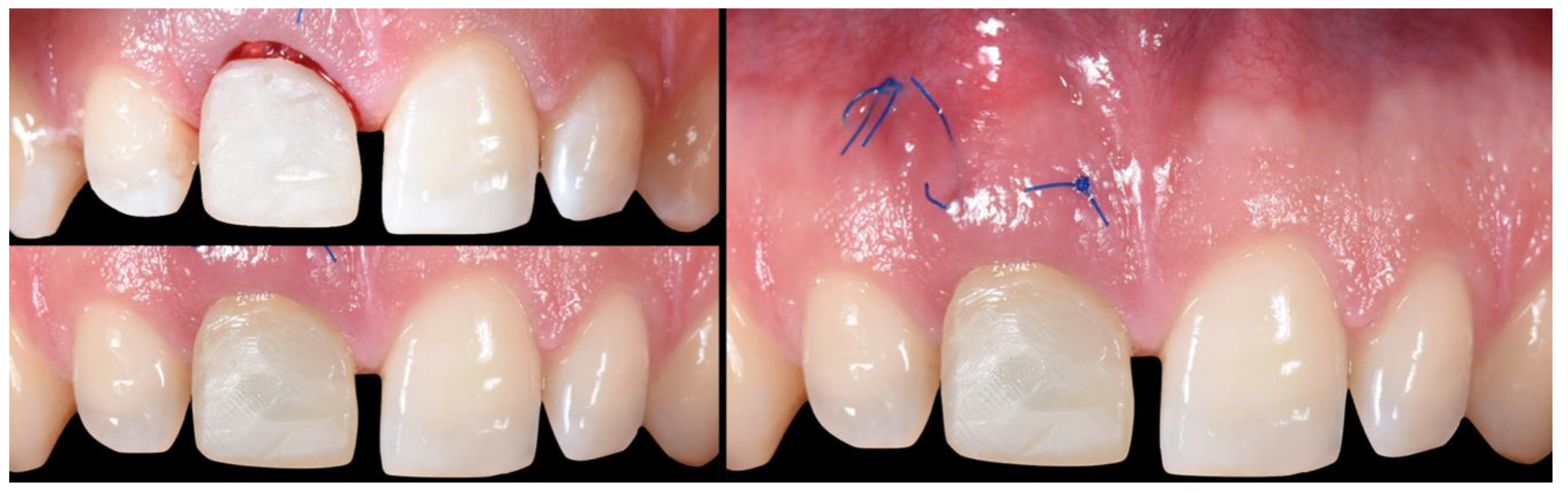 Applsci 10 08944 g011 Applsci 10 08944 g011