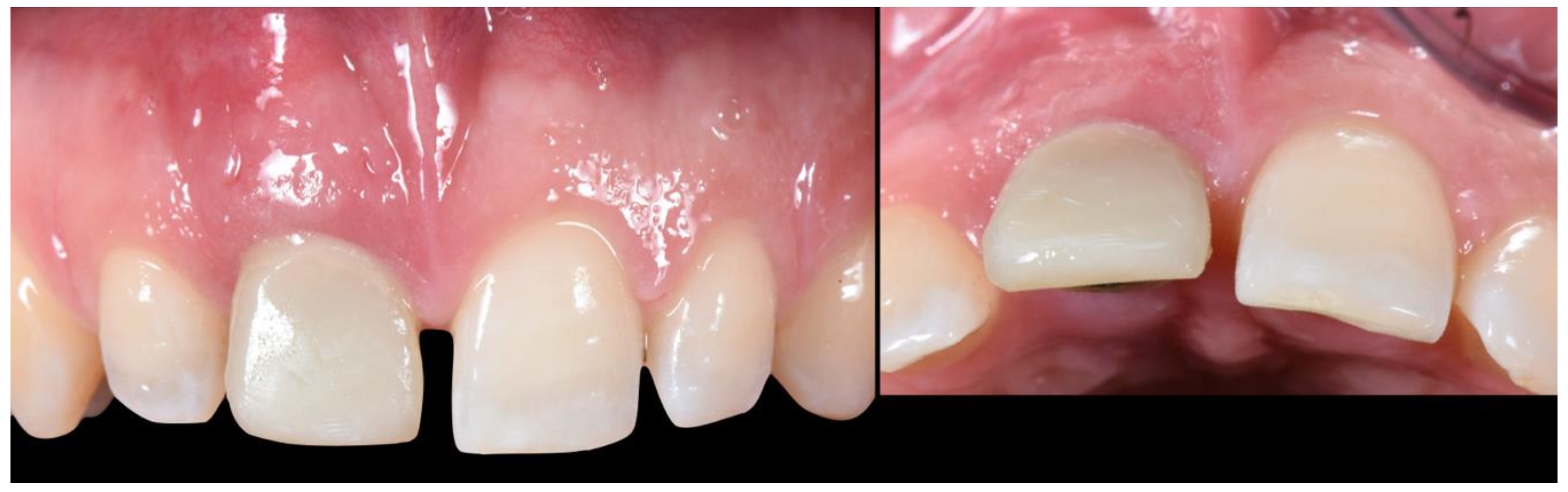 Applsci 10 08944 g012 Applsci 10 08944 g012