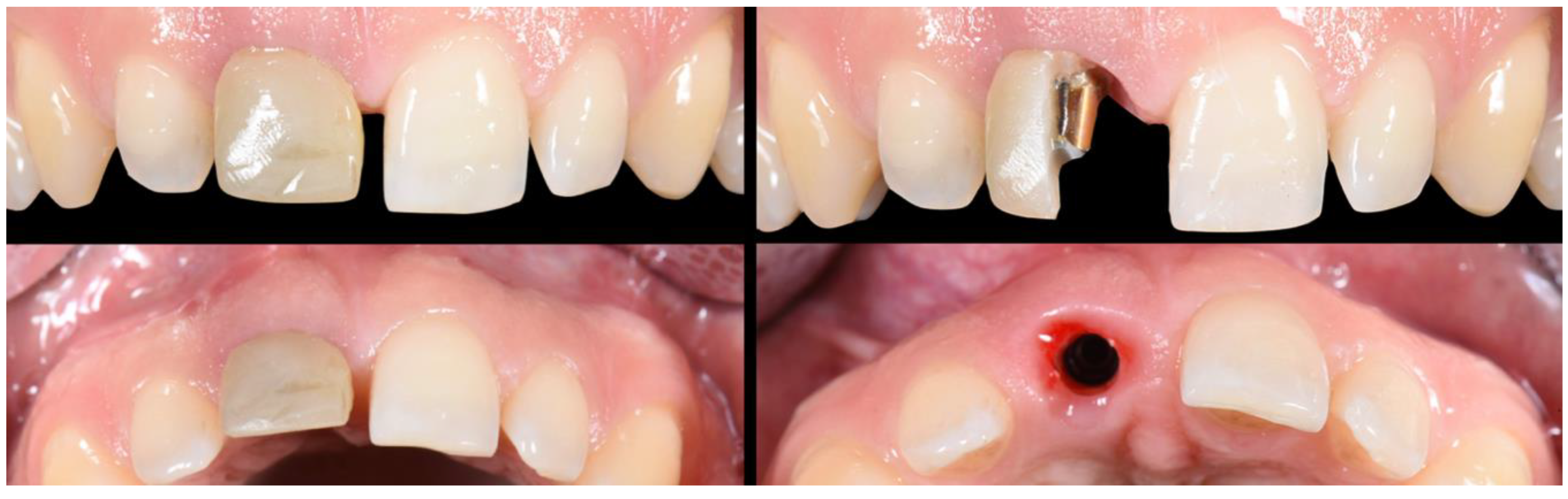 Applsci 10 08944 g013 Applsci 10 08944 g013