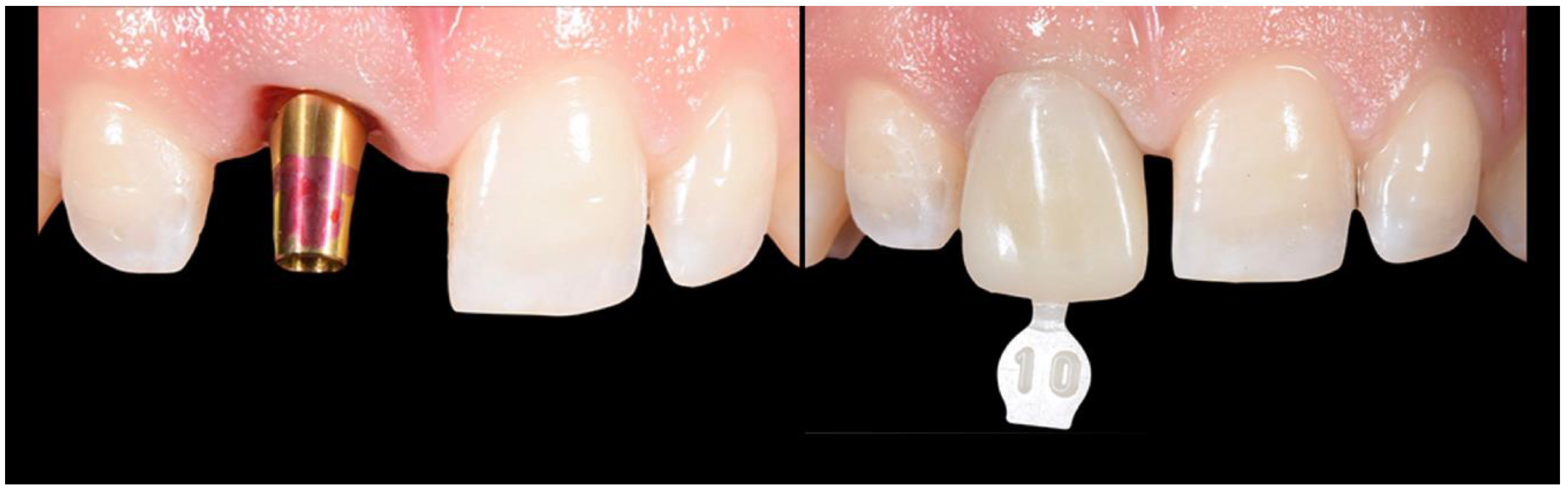 Applsci 10 08944 g014 Applsci 10 08944 g014