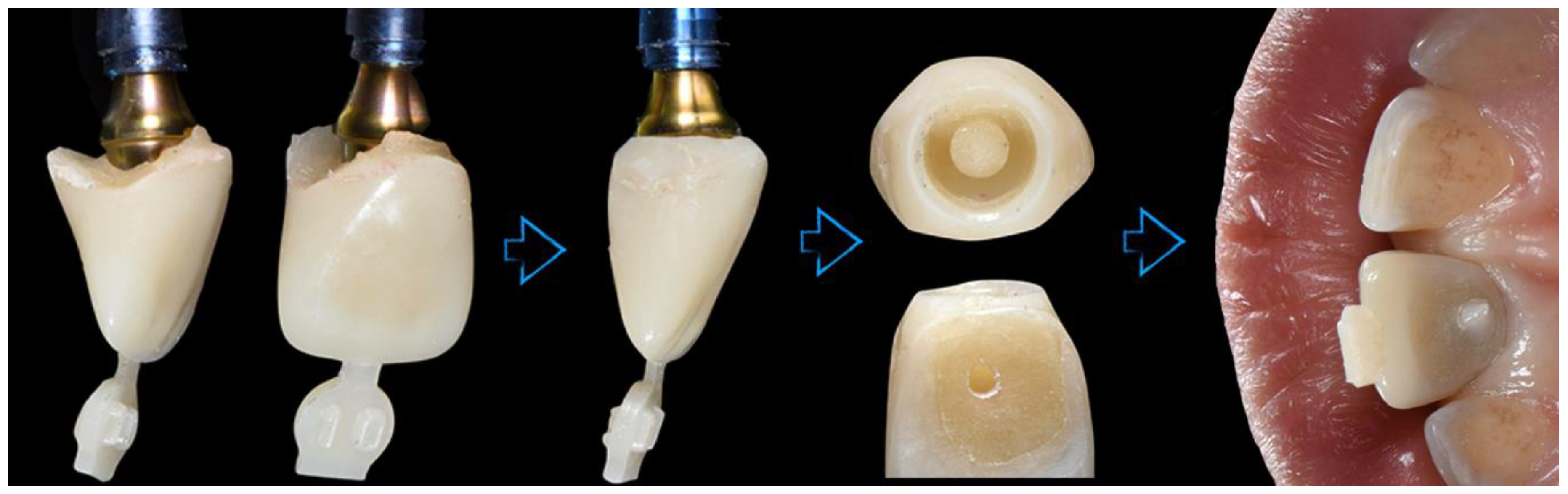 Applsci 10 08944 g015 Applsci 10 08944 g015