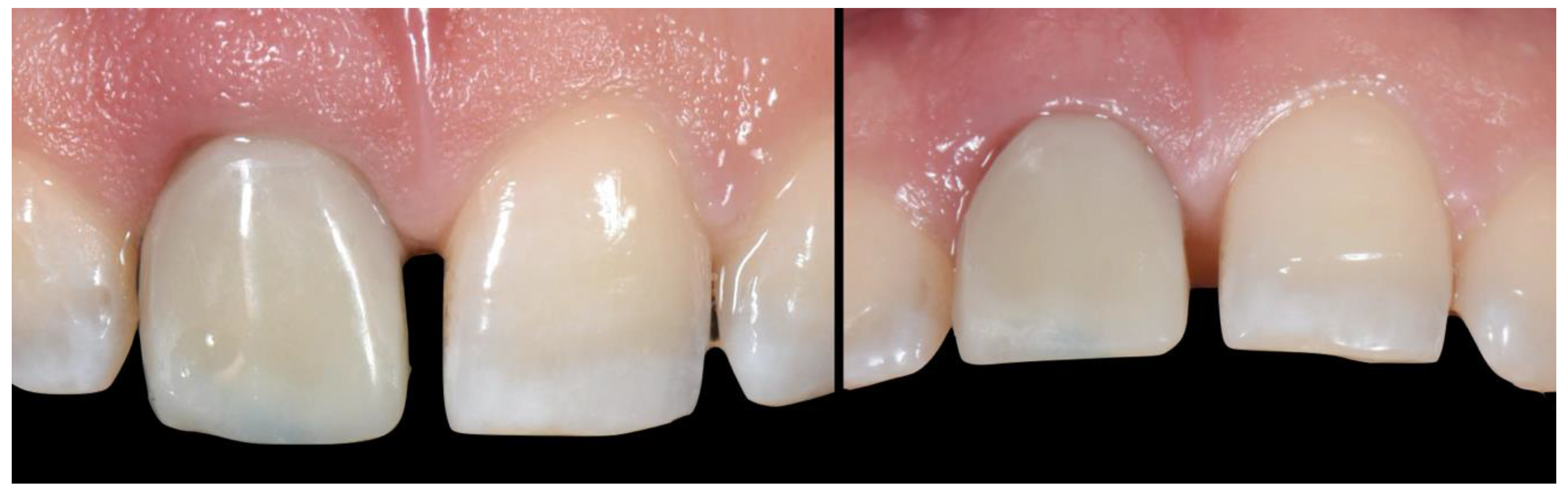 Applsci 10 08944 g016 Applsci 10 08944 g016