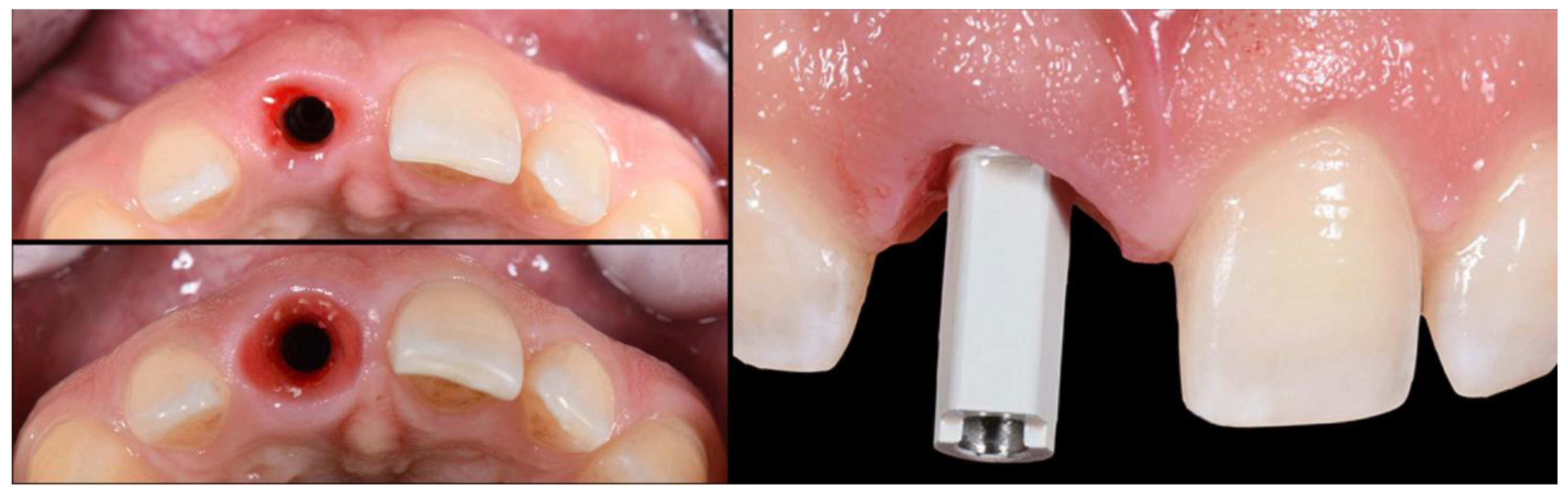 Applsci 10 08944 g017 Applsci 10 08944 g017