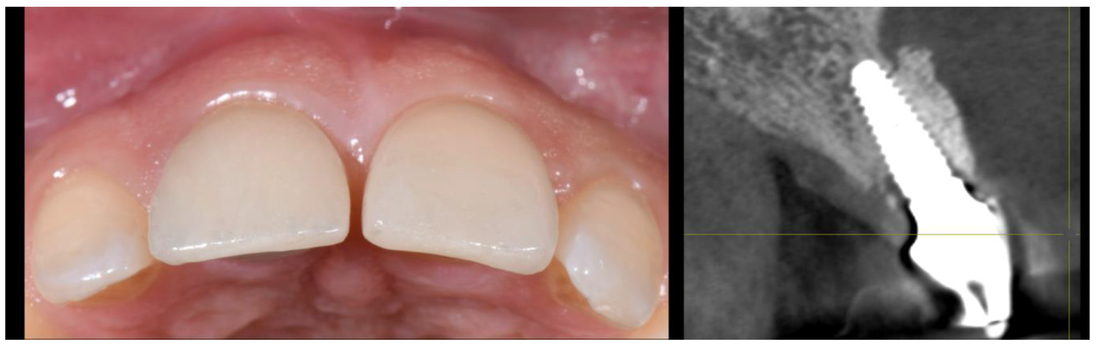 Applsci 10 08944 g020 Applsci 10 08944 g020