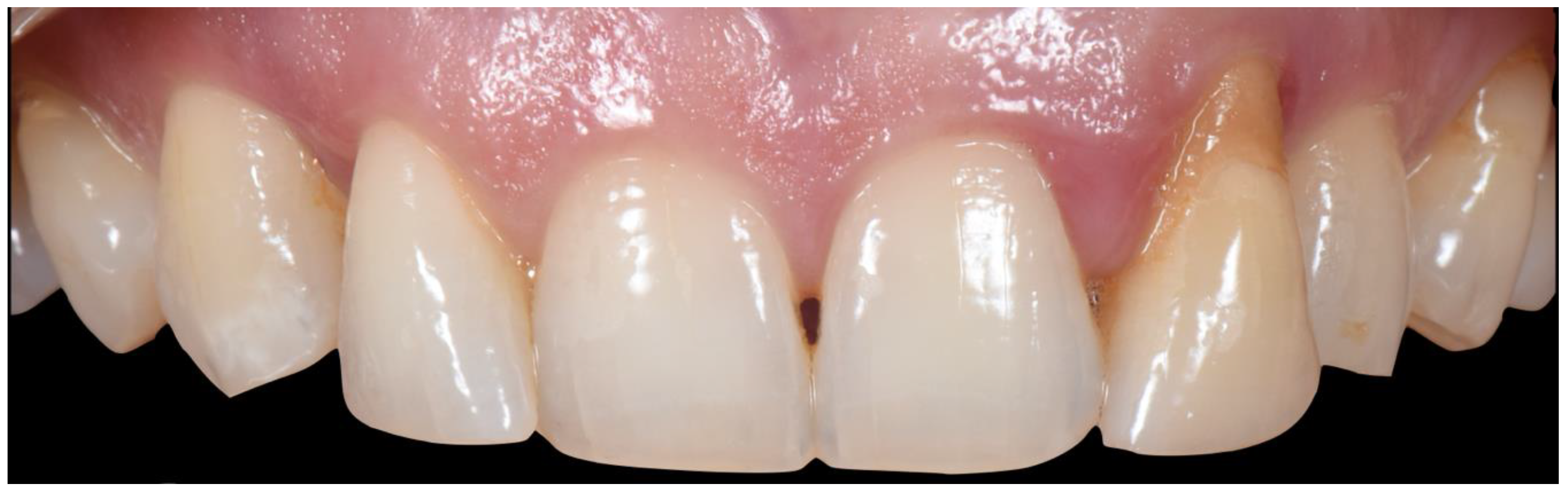 Applsci 10 08944 g021 Applsci 10 08944 g021