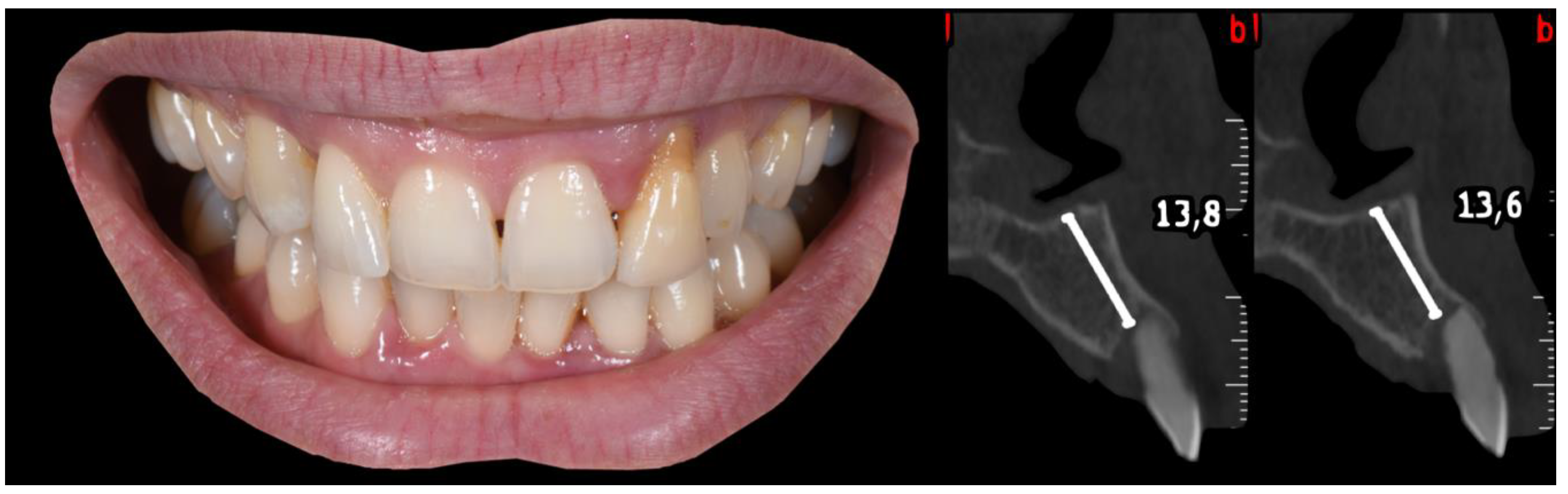 Applsci 10 08944 g022 Applsci 10 08944 g022