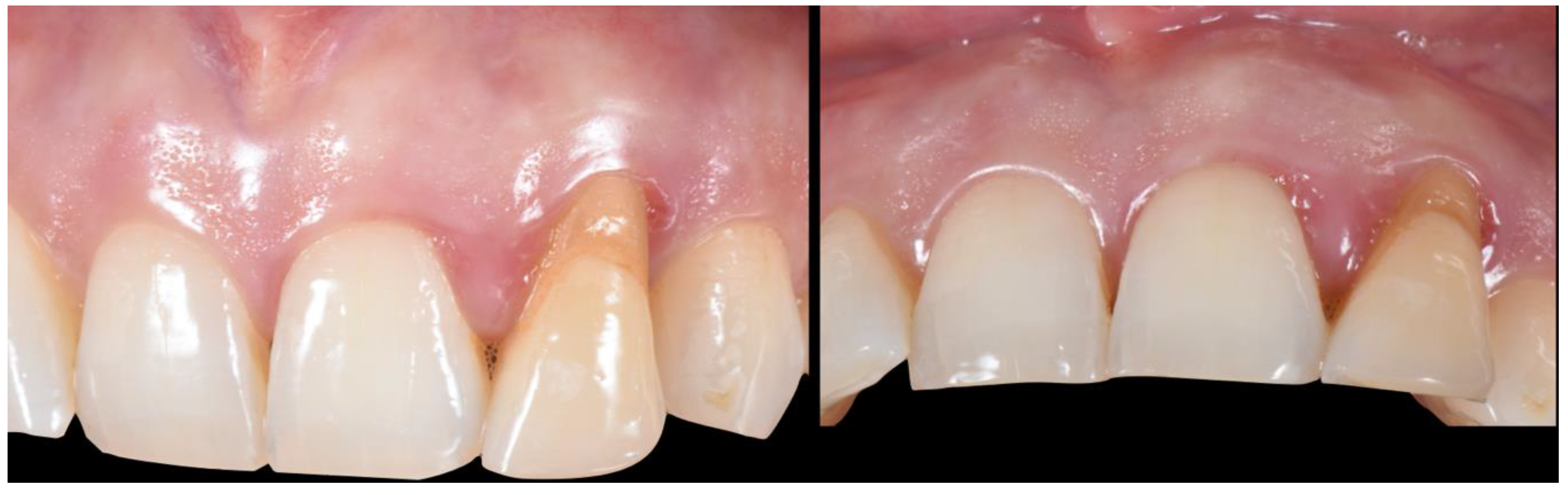 Applsci 10 08944 g023 Applsci 10 08944 g023