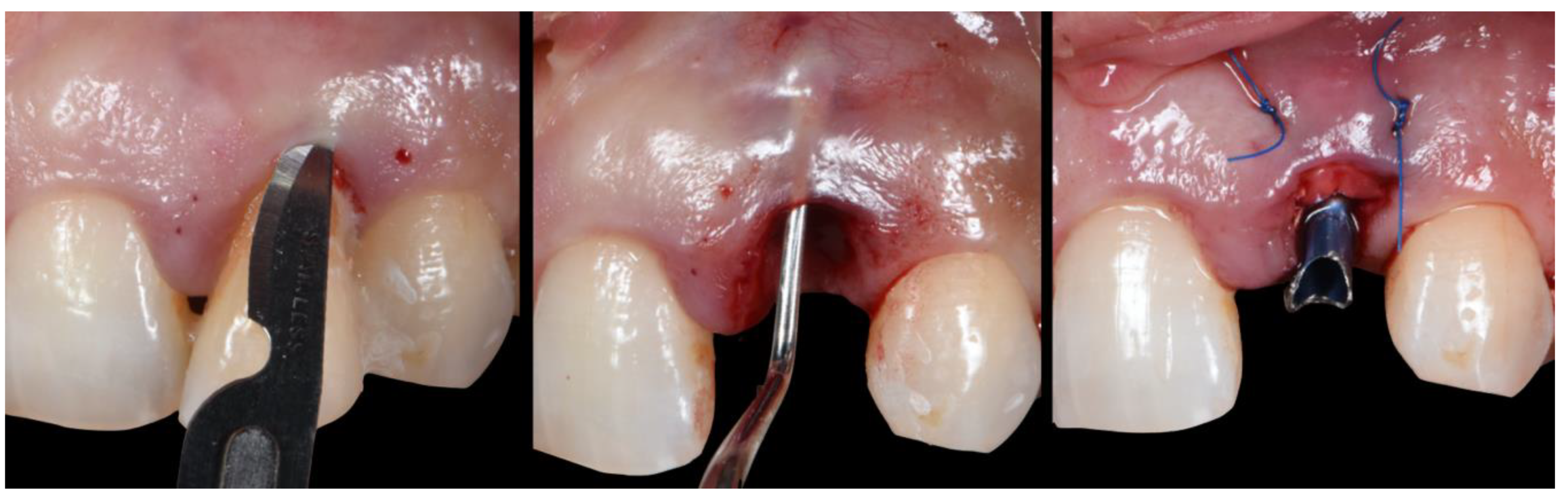 Applsci 10 08944 g024 Applsci 10 08944 g024