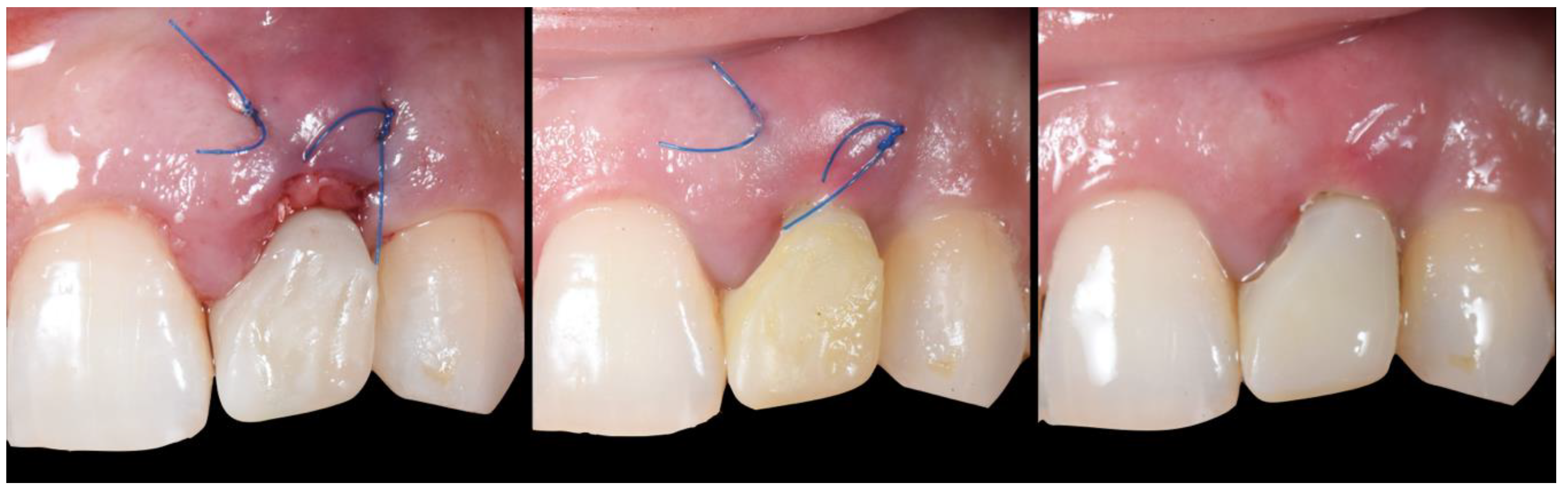 Applsci 10 08944 g025 Applsci 10 08944 g025