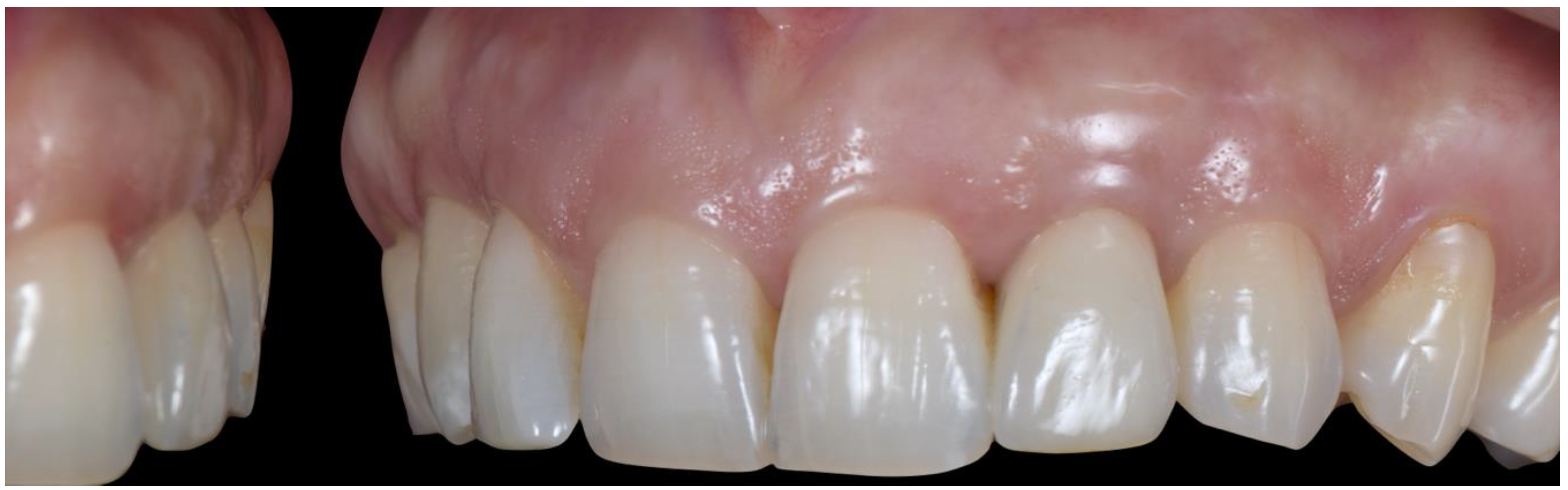 Applsci 10 08944 g027 Applsci 10 08944 g027