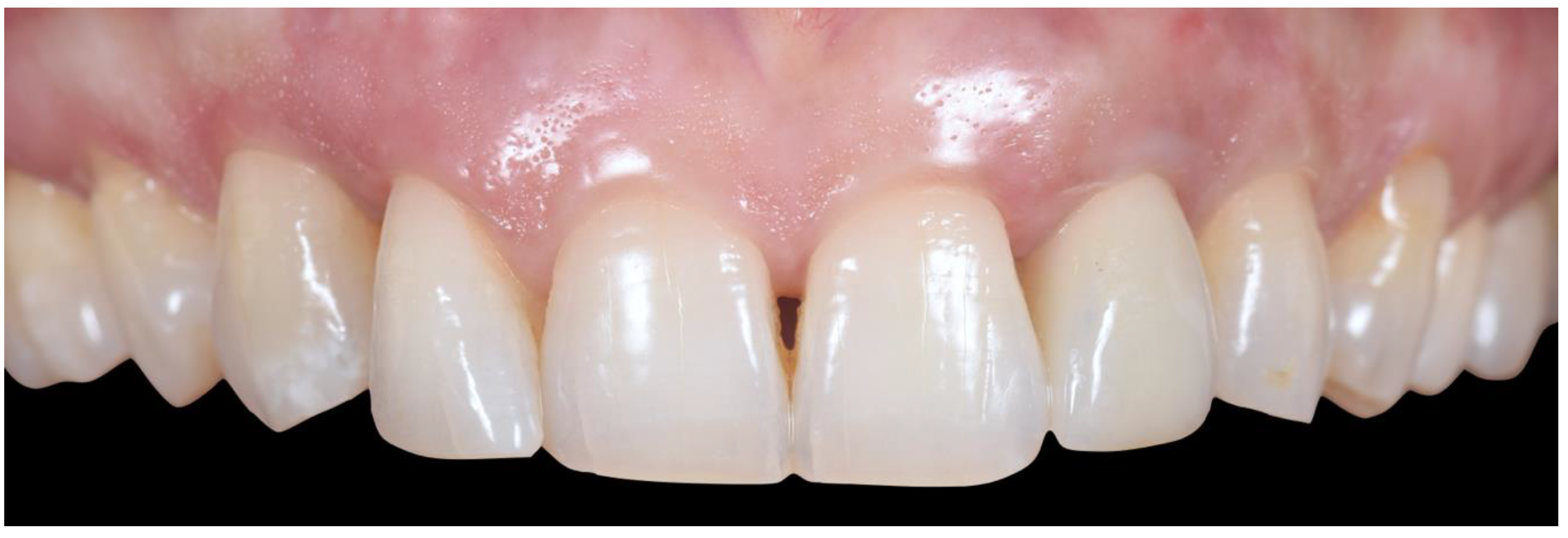 Applsci 10 08944 g028 Applsci 10 08944 g028