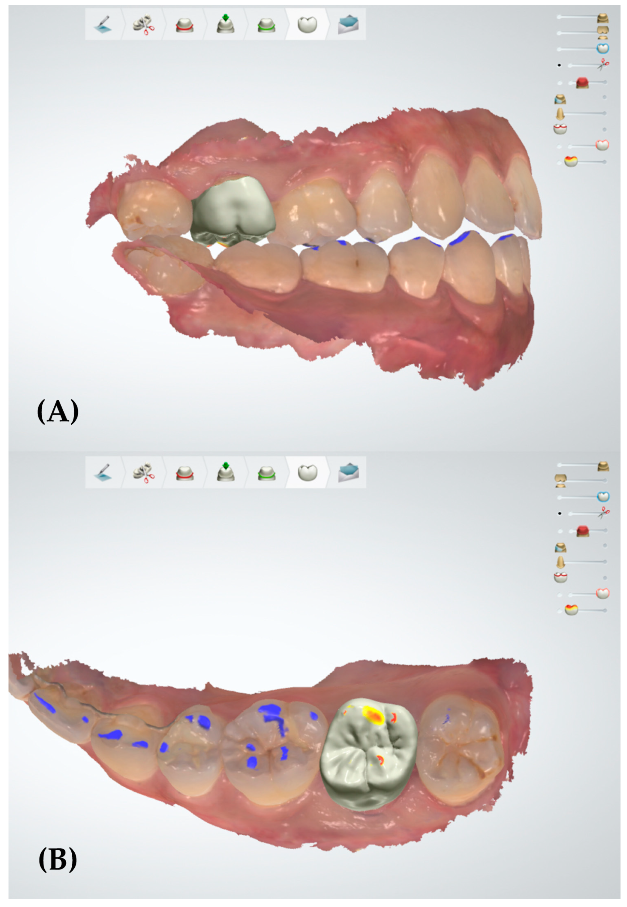 Applsci 10 09140 g003 Applsci 10 09140 g003