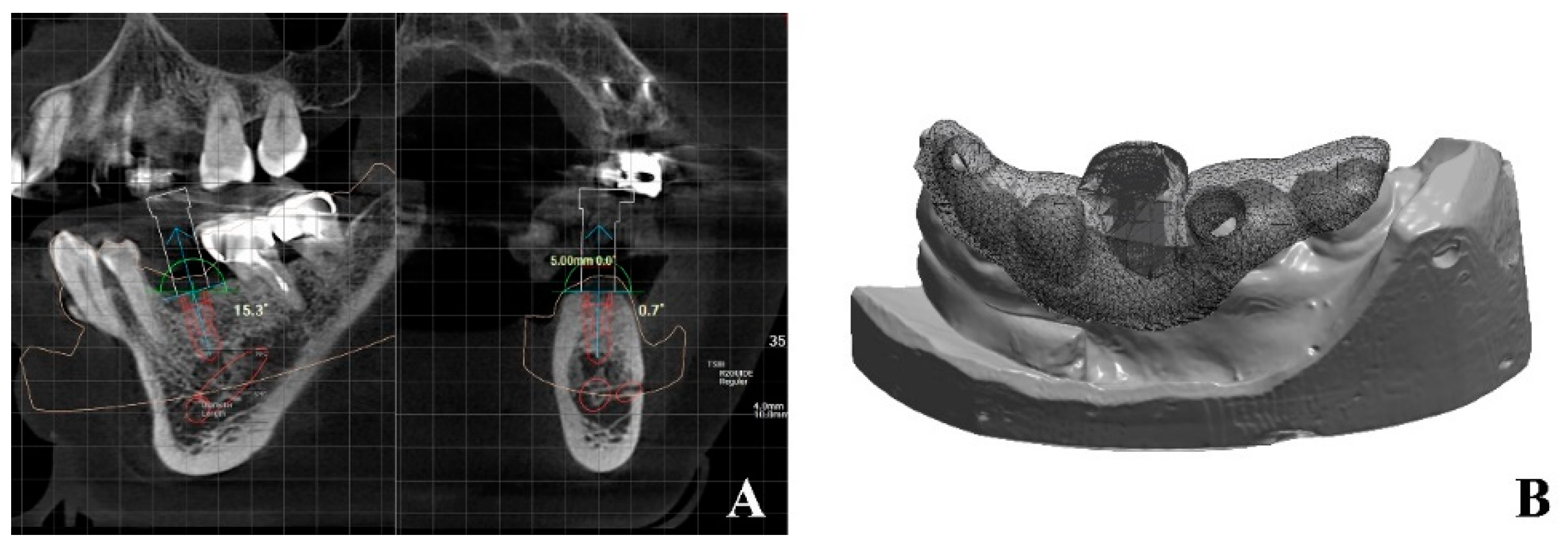 Applsci 11 00049 g002 Applsci 11 00049 g002