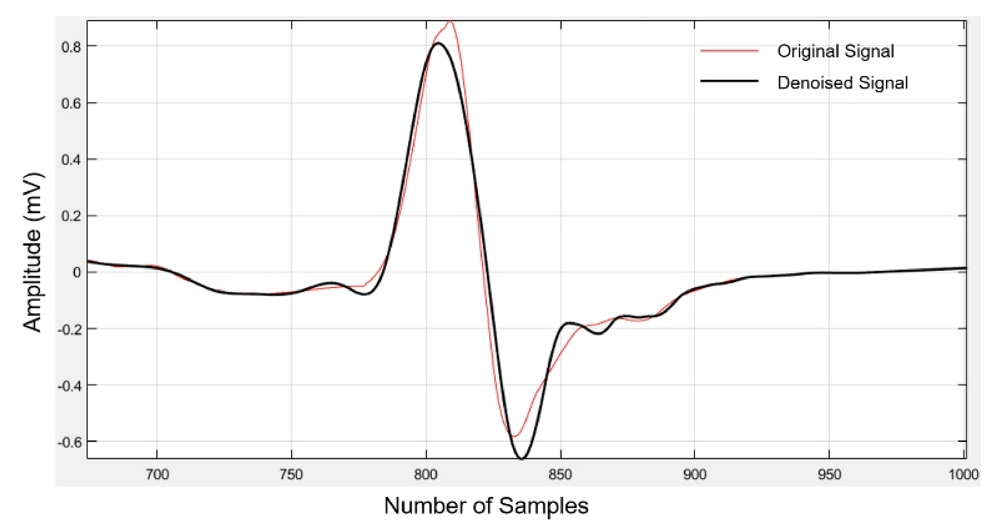 denoising ecg signal using wavelet matlab code