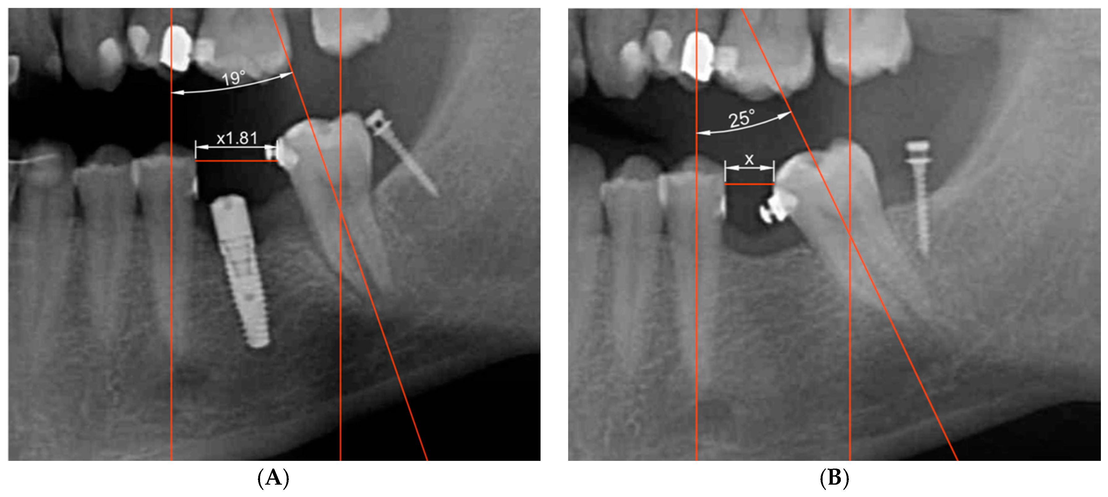 Applsci 11 00607 g003