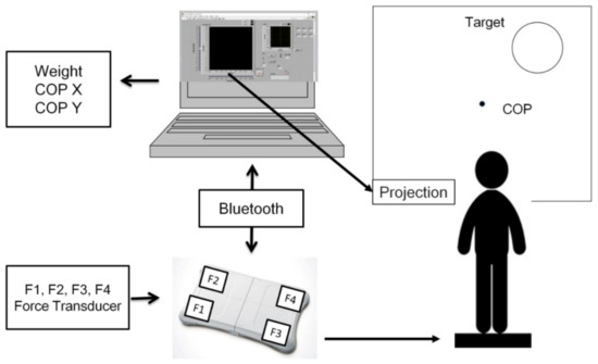 Evaluation of Anticipatory Postural Adjustment before Quantified Weight ...