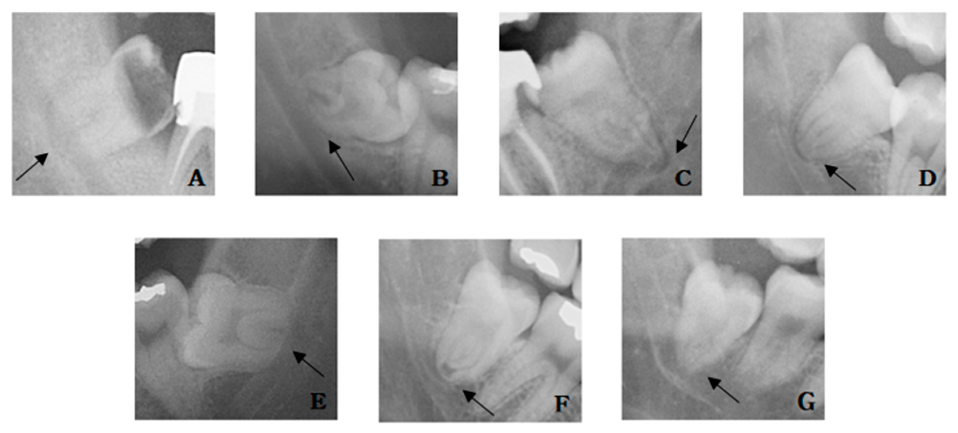 Applsci 11 00816 g004