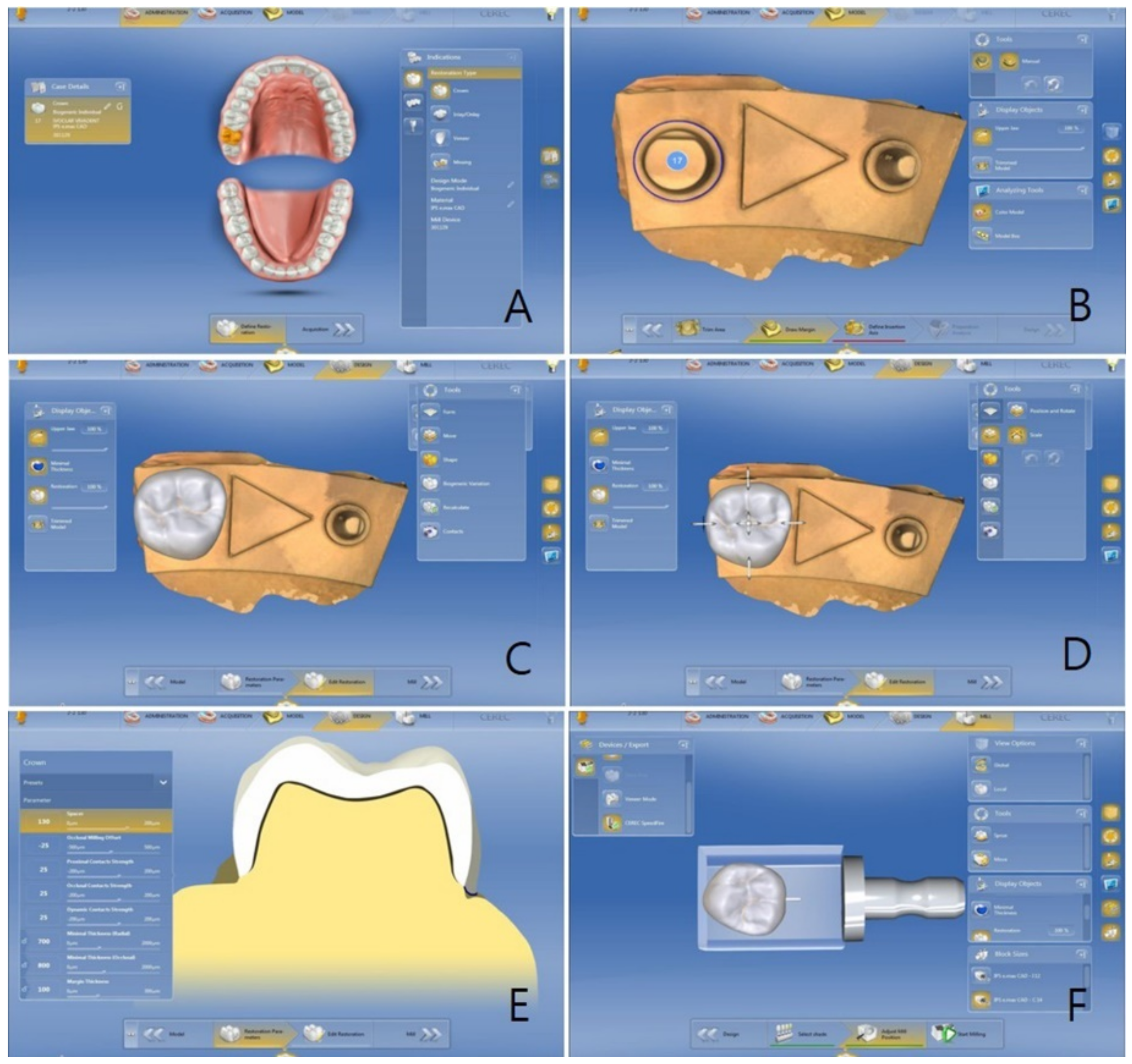 cerec accept