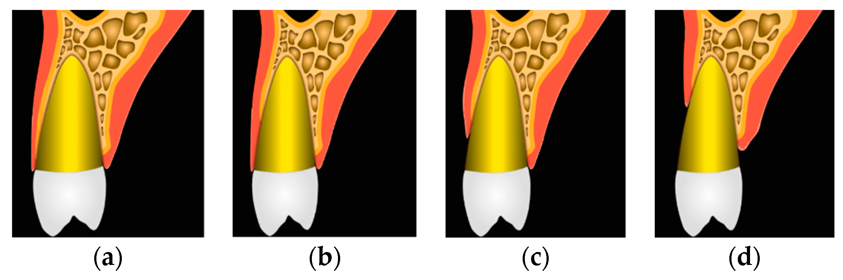 Applied Sciences Free FullText The Effect of Different Socket