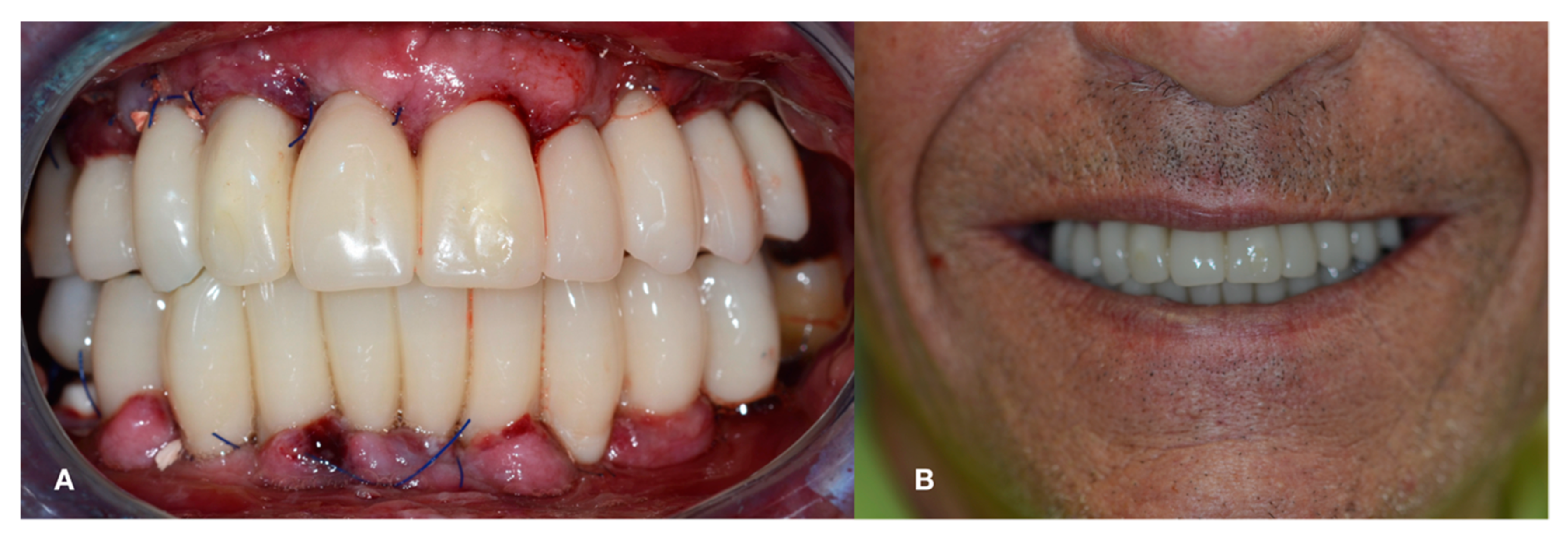 Applsci 11 00996 g011