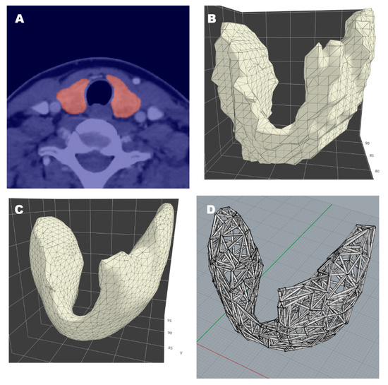 Applied Sciences Free FullText MeshType ThreeDimensional (3D